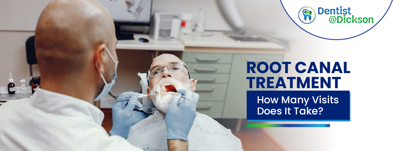 Root Canal Treatment: How Many Visits Does It Take?